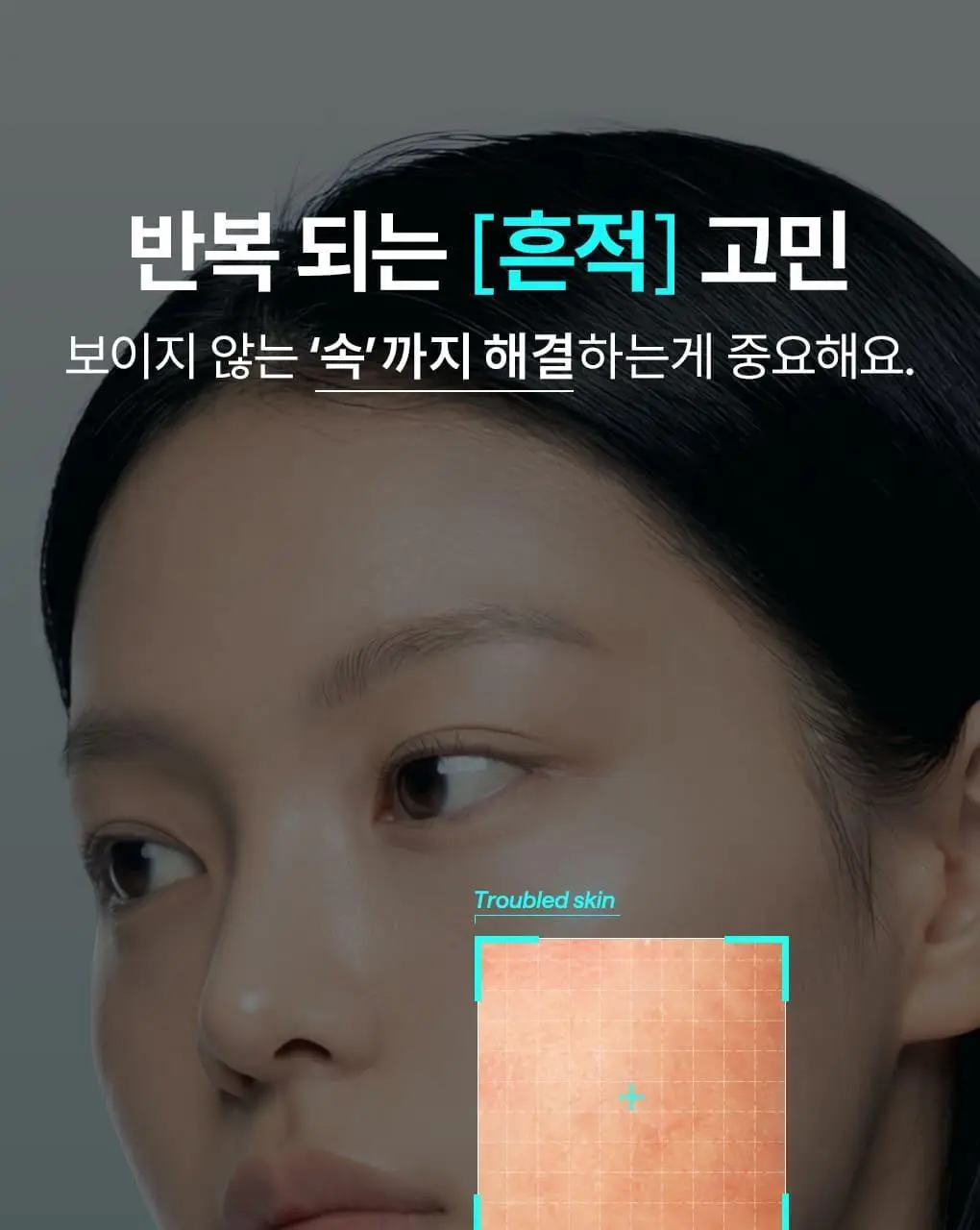 [패드증정/단독] 메디힐 마데카소사이드 흔적 리페어 더마 크림 50ml 기획 (+마데카소사이드 패드 2매*3개) 상세페이지 7